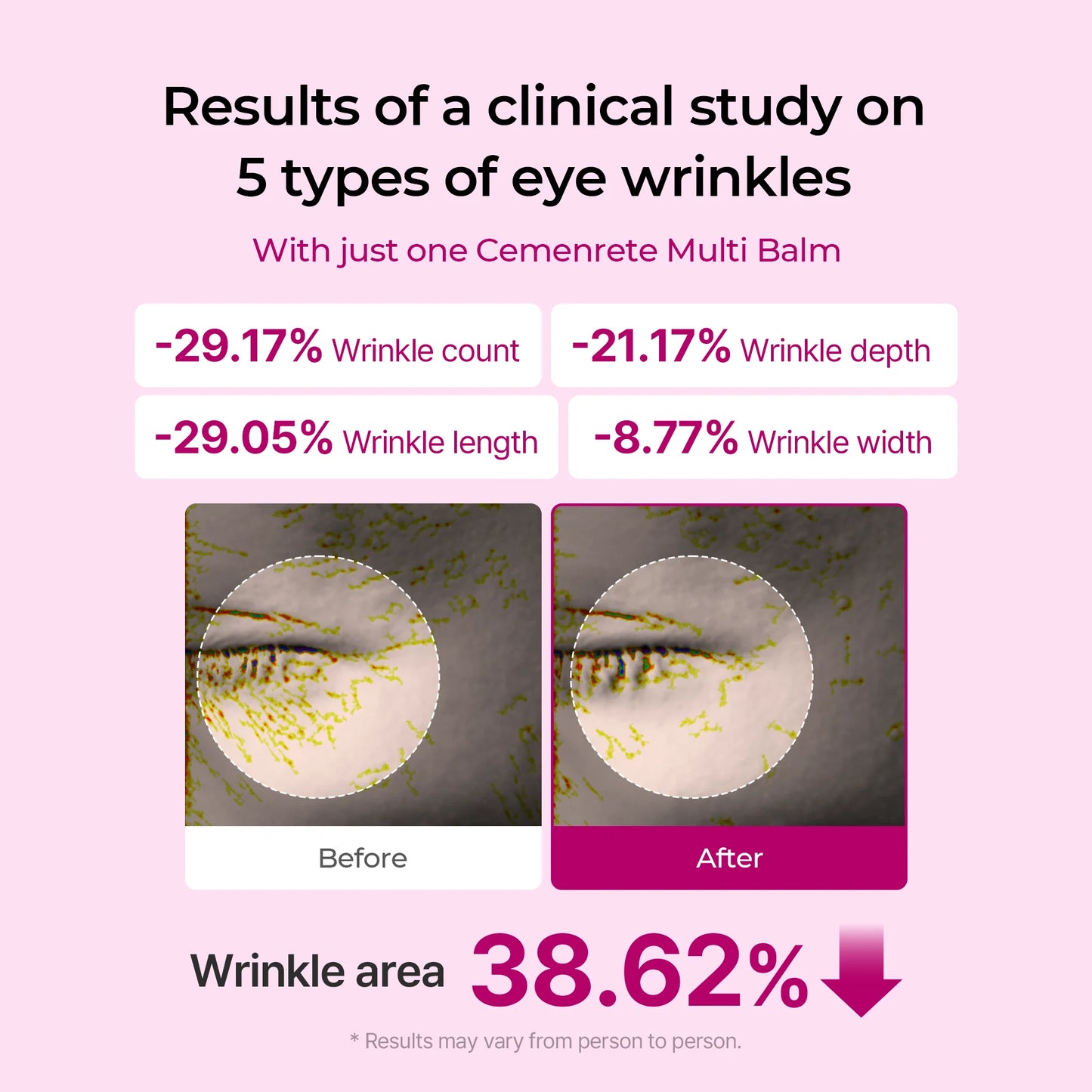 Anti Wrinkle Calcium Balm