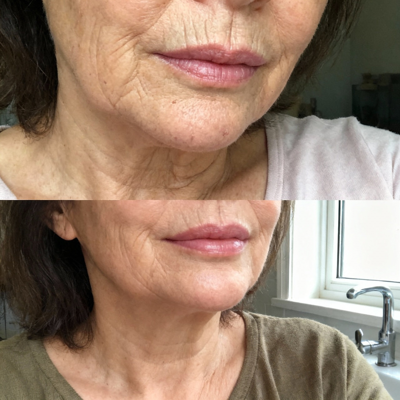 Anti Wrinkle Calcium Balm