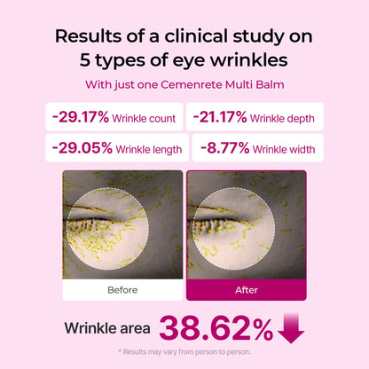 Anti Wrinkle Calcium Balm