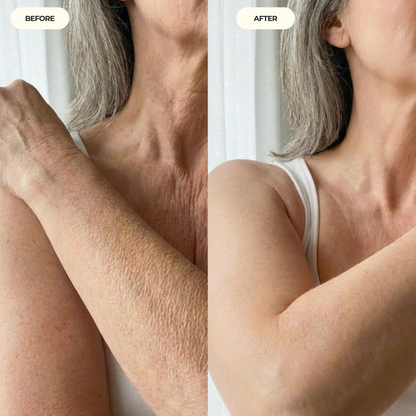 HA Hydrating Body Serum - Crepey Arms Formula