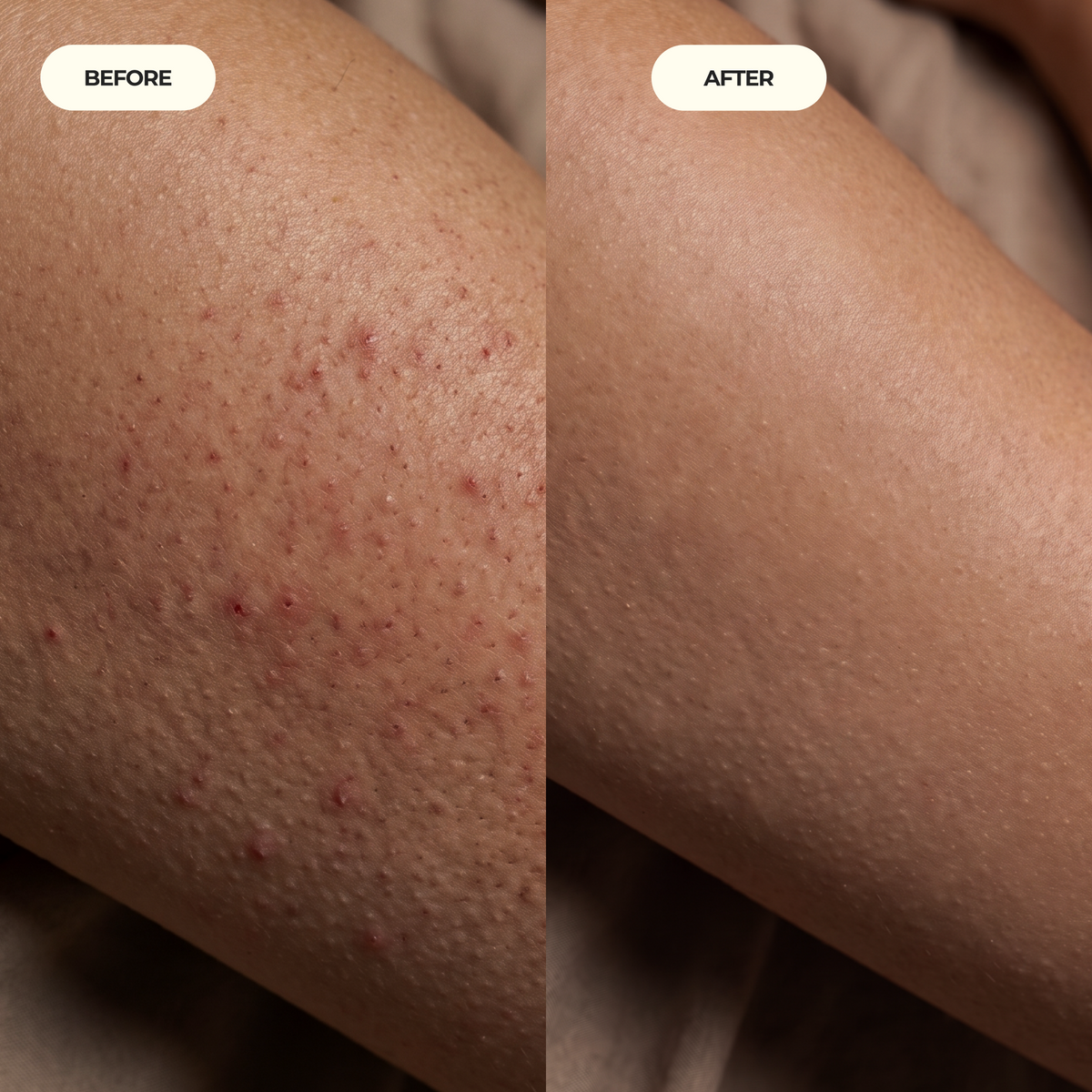 Kojic Acid Turmeric spray - Dark Spot Formula