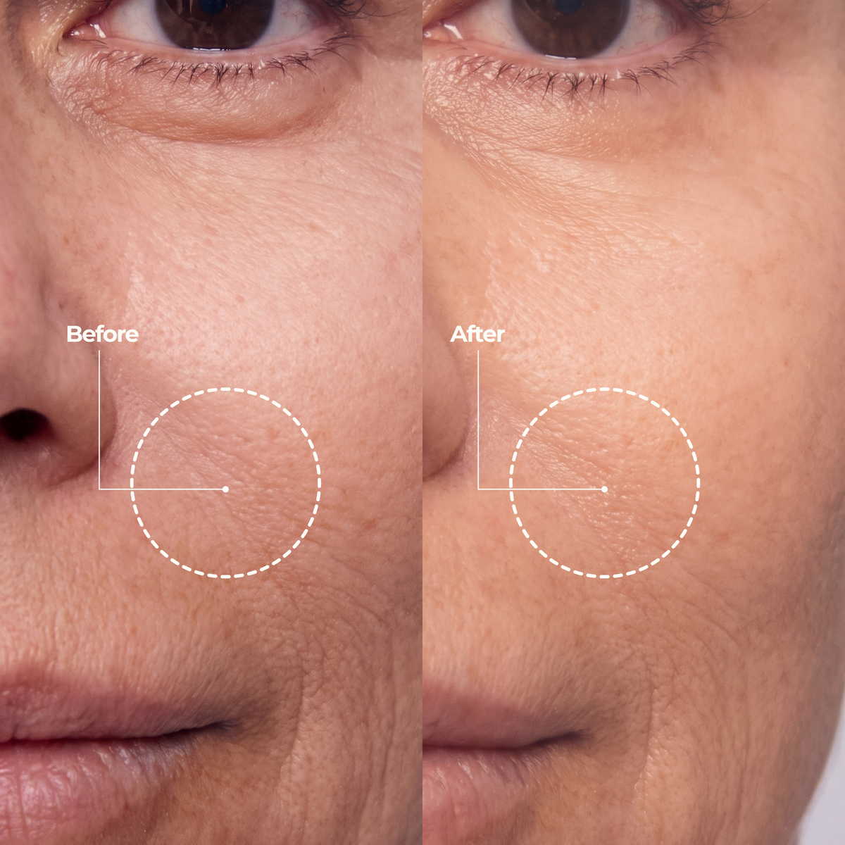 Anti Wrinkle Calcium Balm