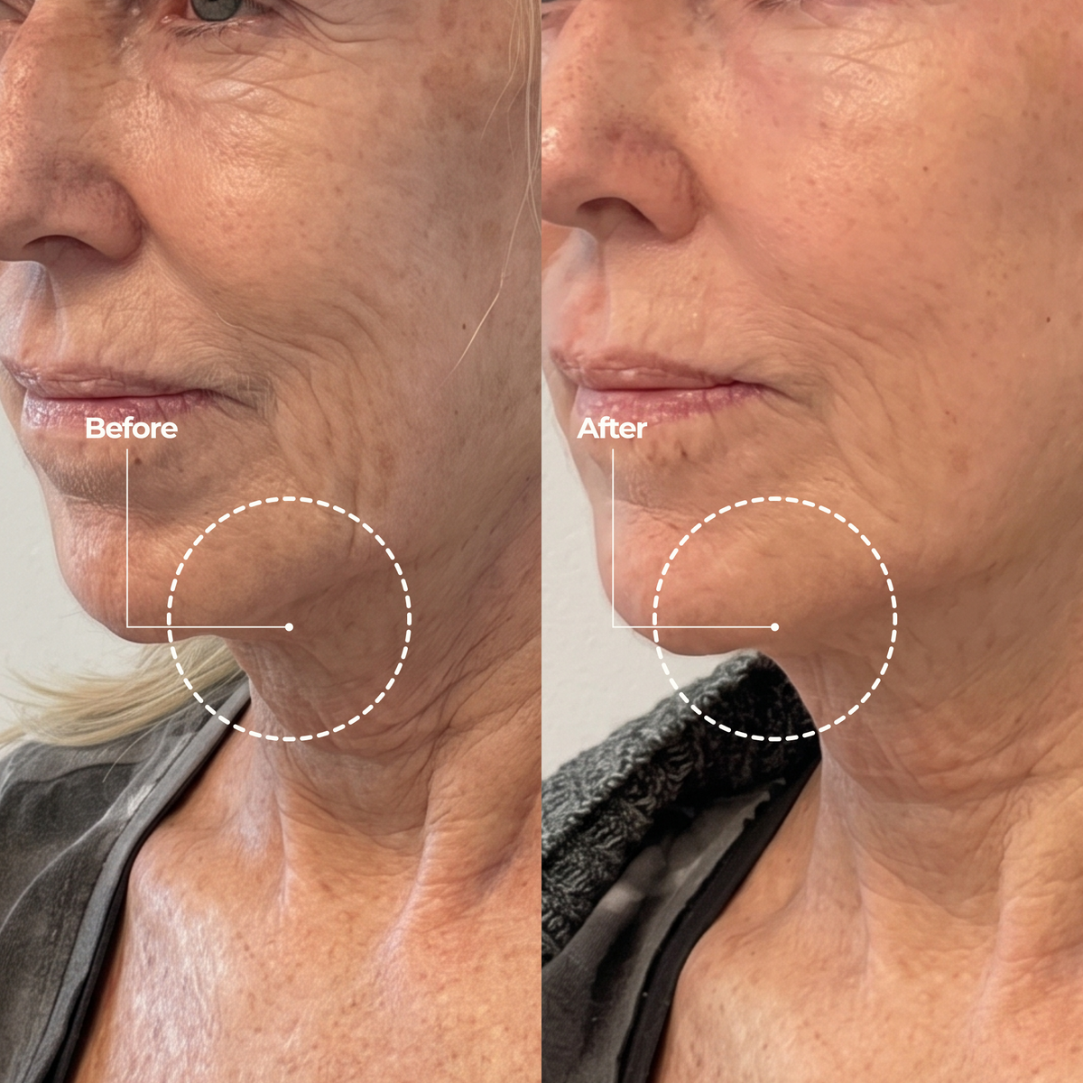 Anti Wrinkle Calcium Balm
