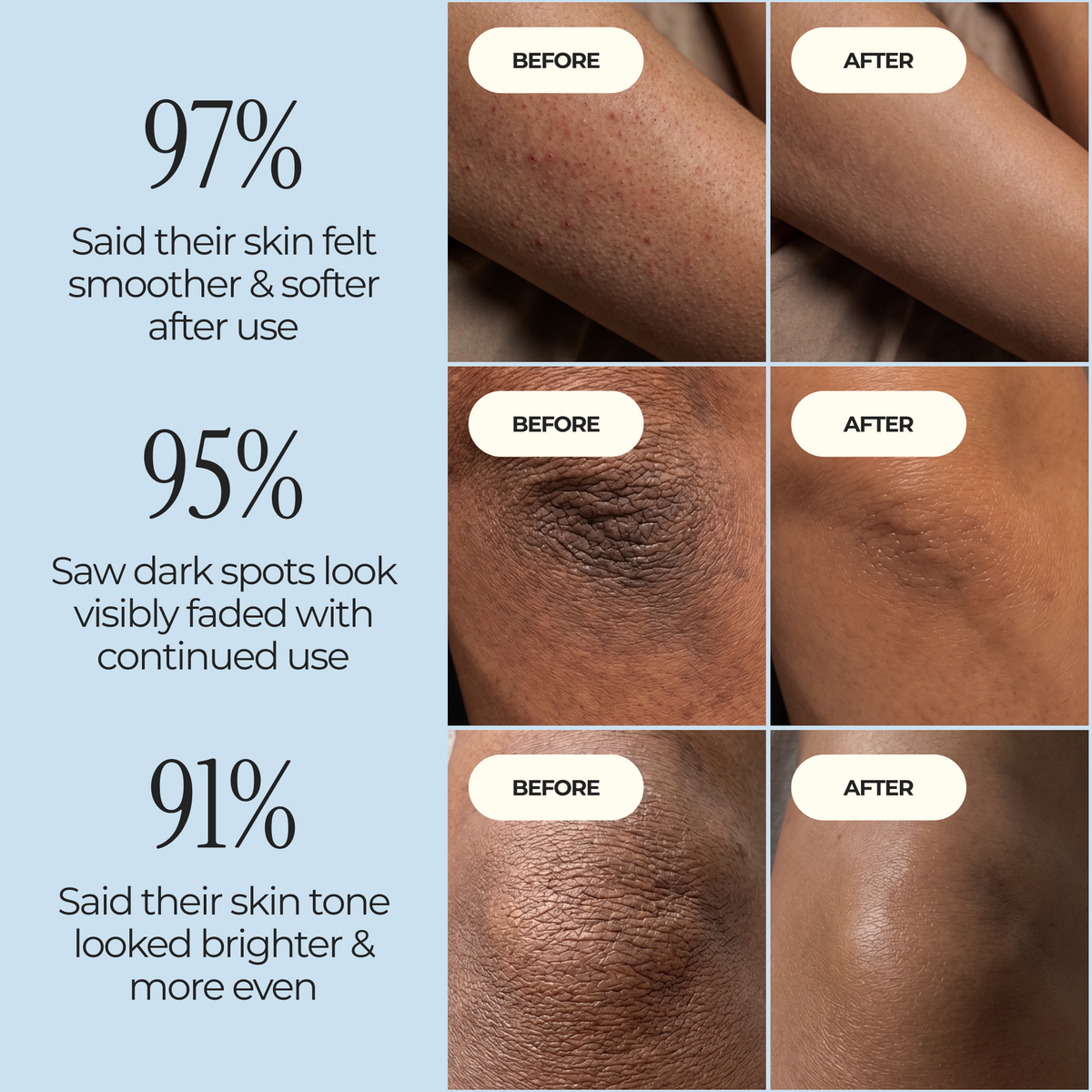 Kojic Acid Turmeric spray - Dark Spot Formula