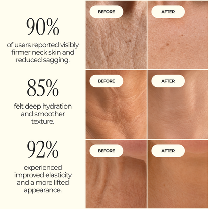 Neck Tightening Cream
