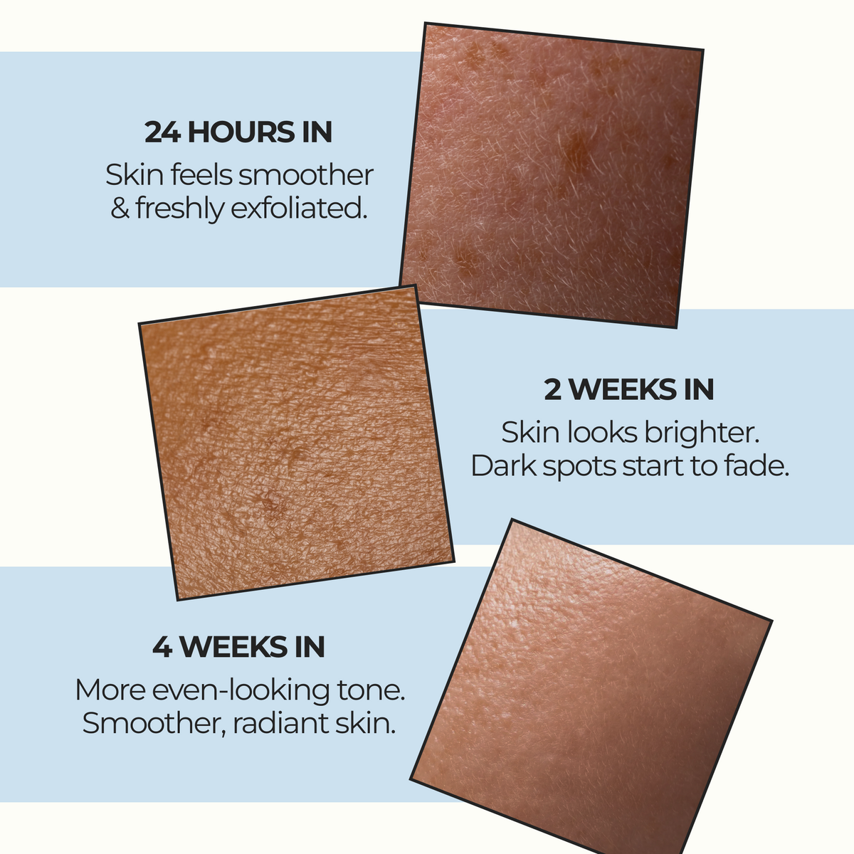 Kojic Acid Turmeric spray - Dark Spot Formula
