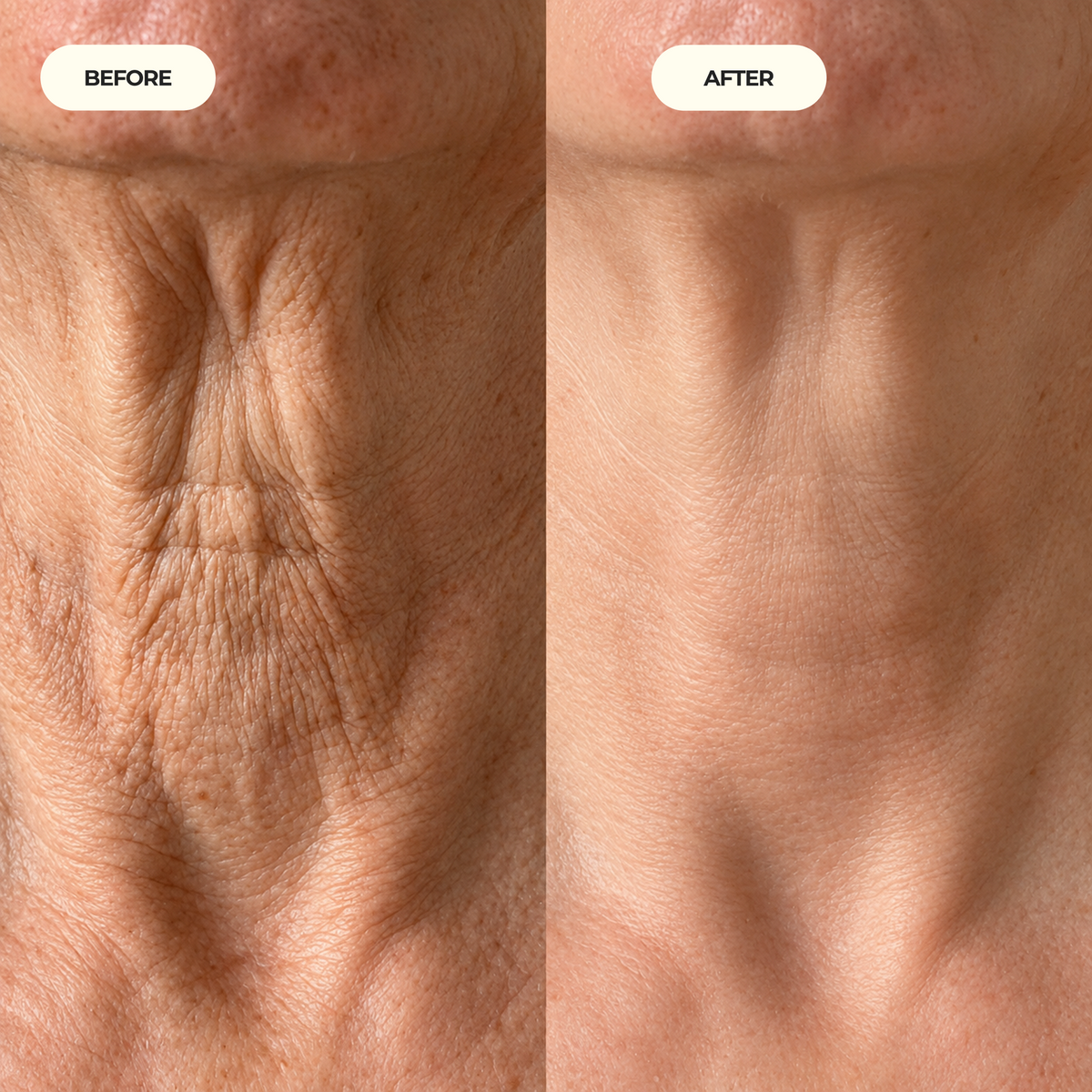 Neck Tightening Cream