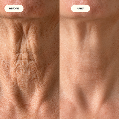 Neck Tightening Cream