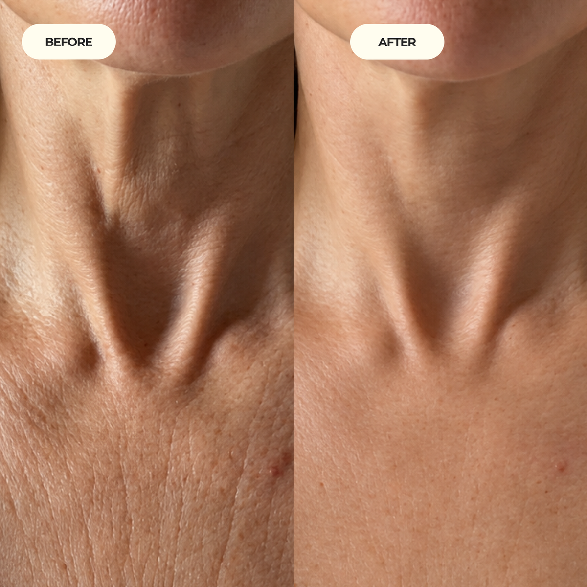 Neck Tightening Cream