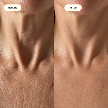 Neck Tightening Cream