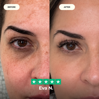 Calcium Dark Spot Eye Cream