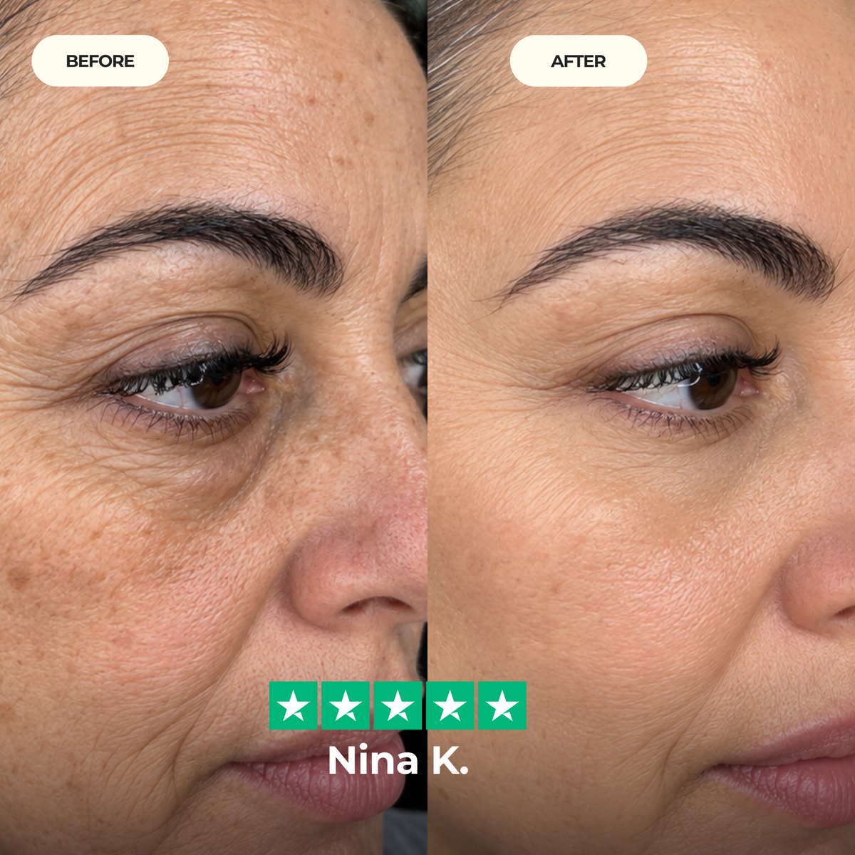 Calcium Dark Spot Eye Cream