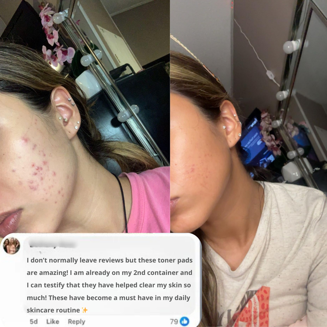 Korean Toning Polish Pads