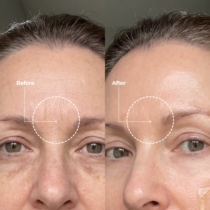 Korean Silk Peptide Botox Serum