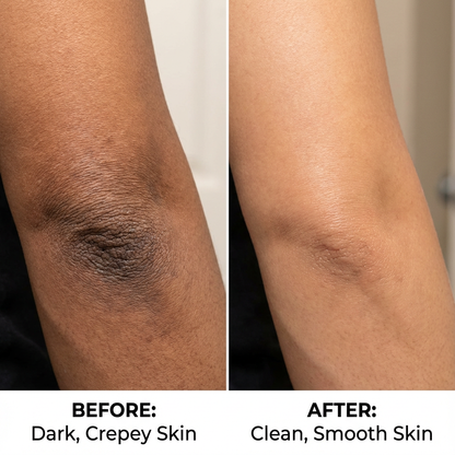 Kojic Acid Turmeric spray - Dark Spot Formula