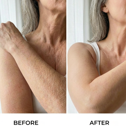 HA Hydrating Body Serum - Crepey Arms Formula