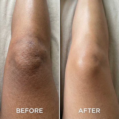 Kojic Acid Turmeric spray - Dark Spot Formula