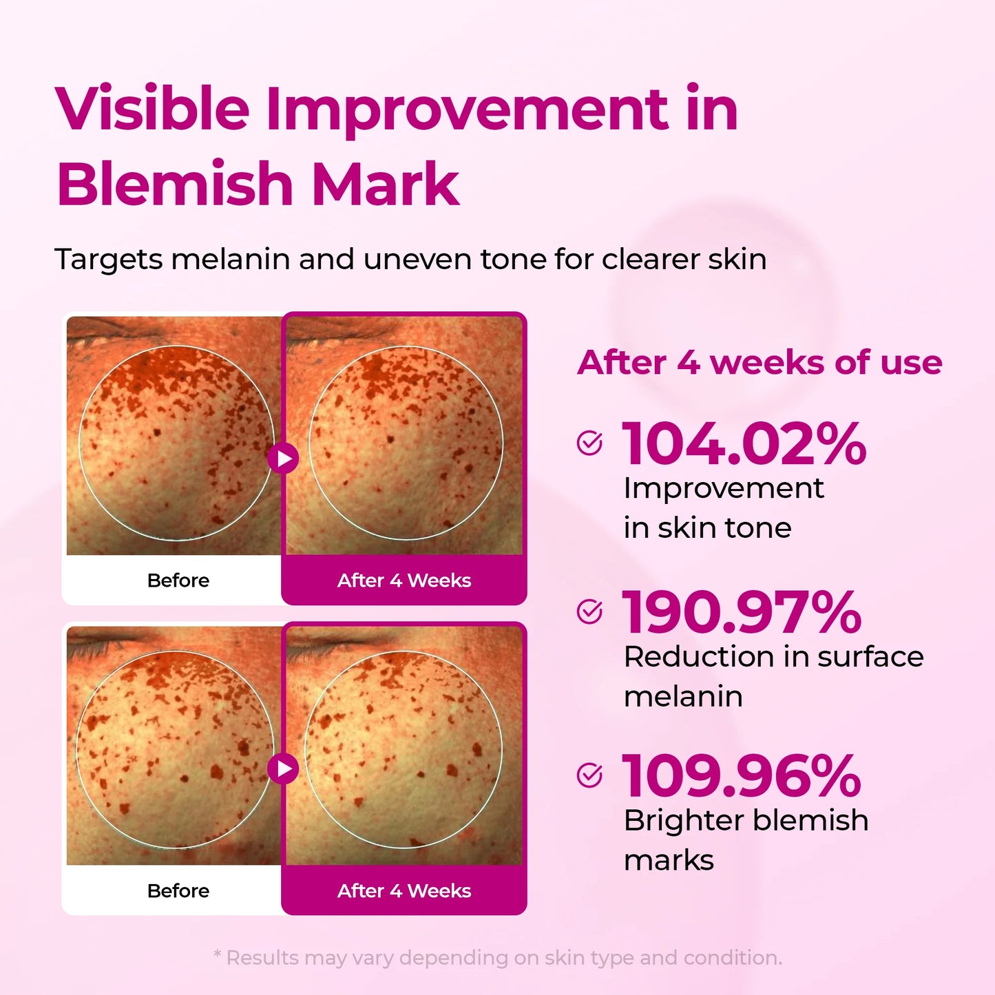 Korean Lumi Pore & Spot Care Duo
