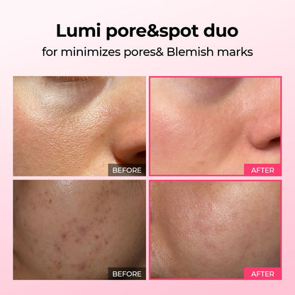 Korean Lumi Pore & Spot Care Duo