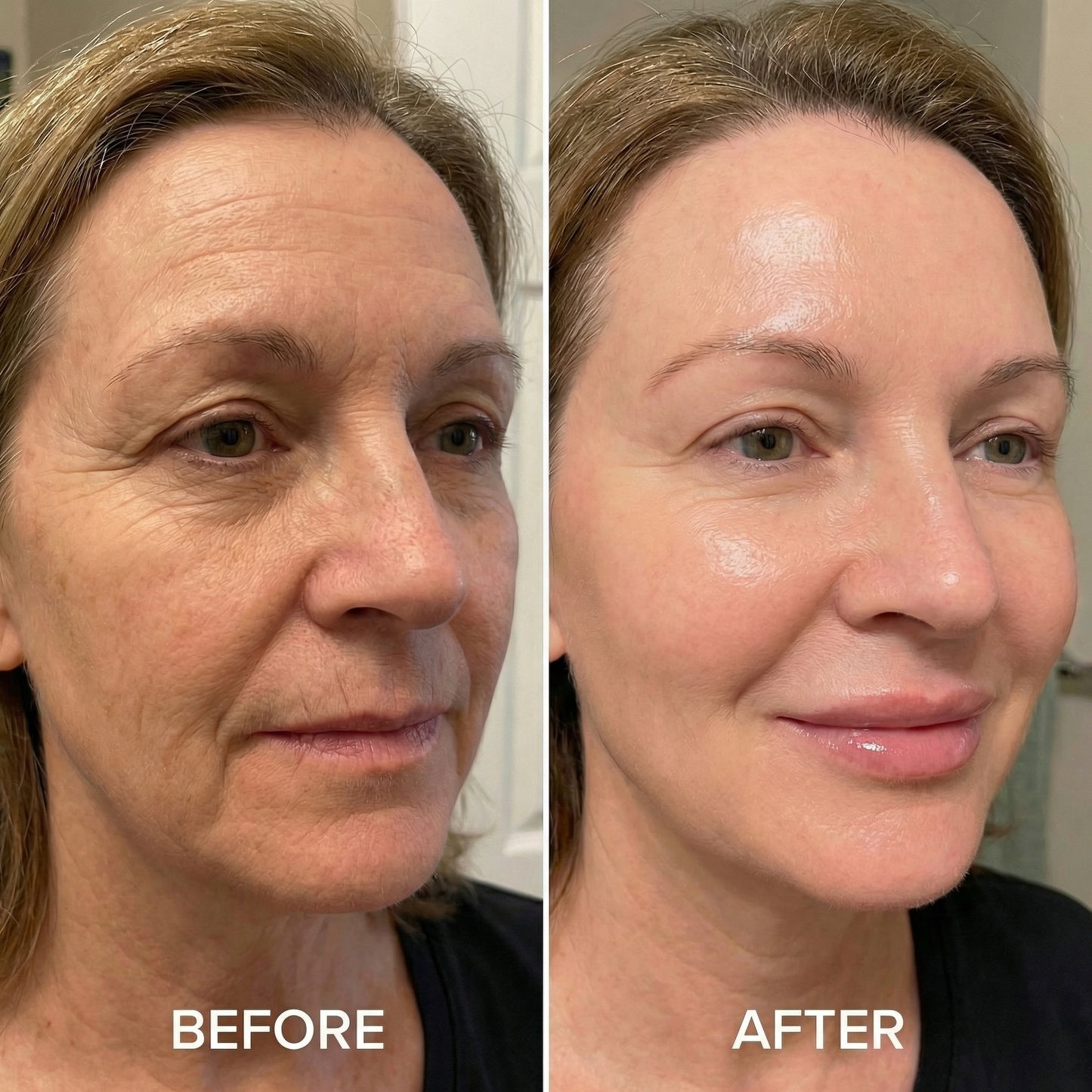 Korean Deep Collagen X Volufiline Serum