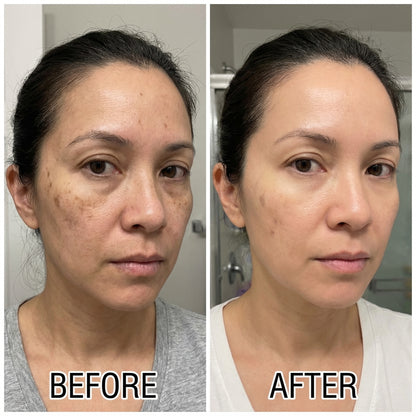 Calcium Dark Spot Eye Cream