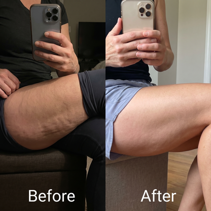 Cellulite Tightening Cream