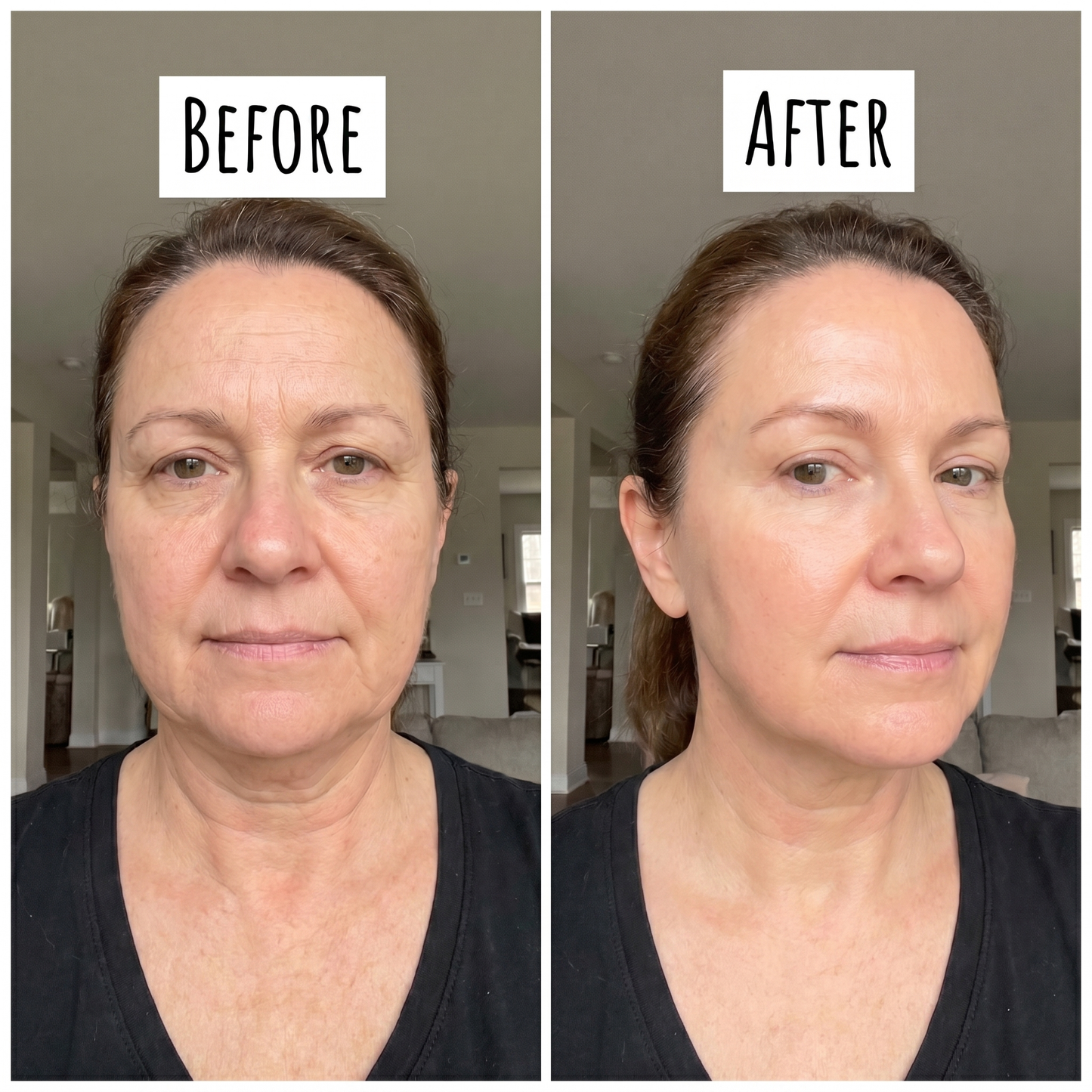 VitaliQ NAD EGF Firming Serum