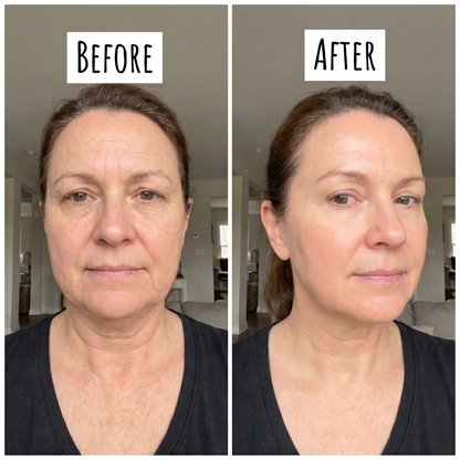 VitaliQ NAD EGF Firming Serum
