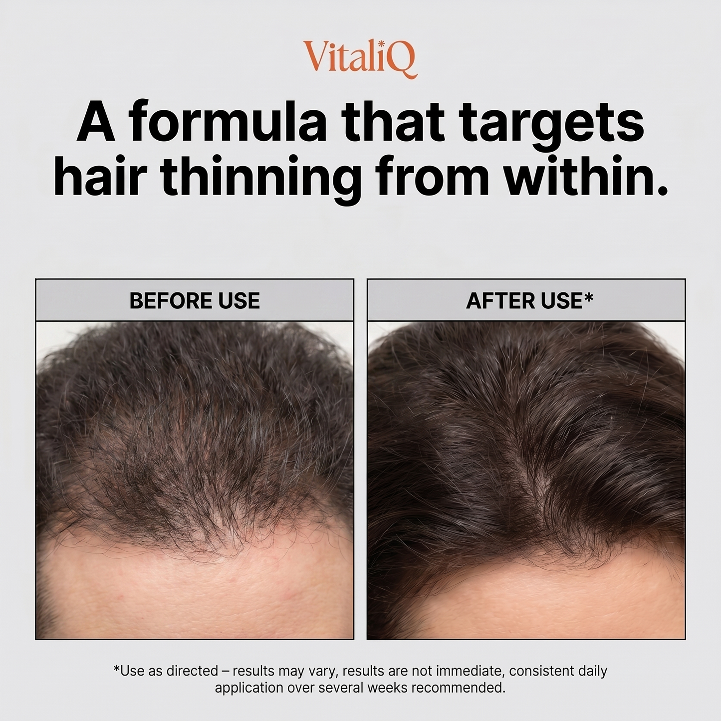 VitaliQ Advanced Hair Growth Serum
