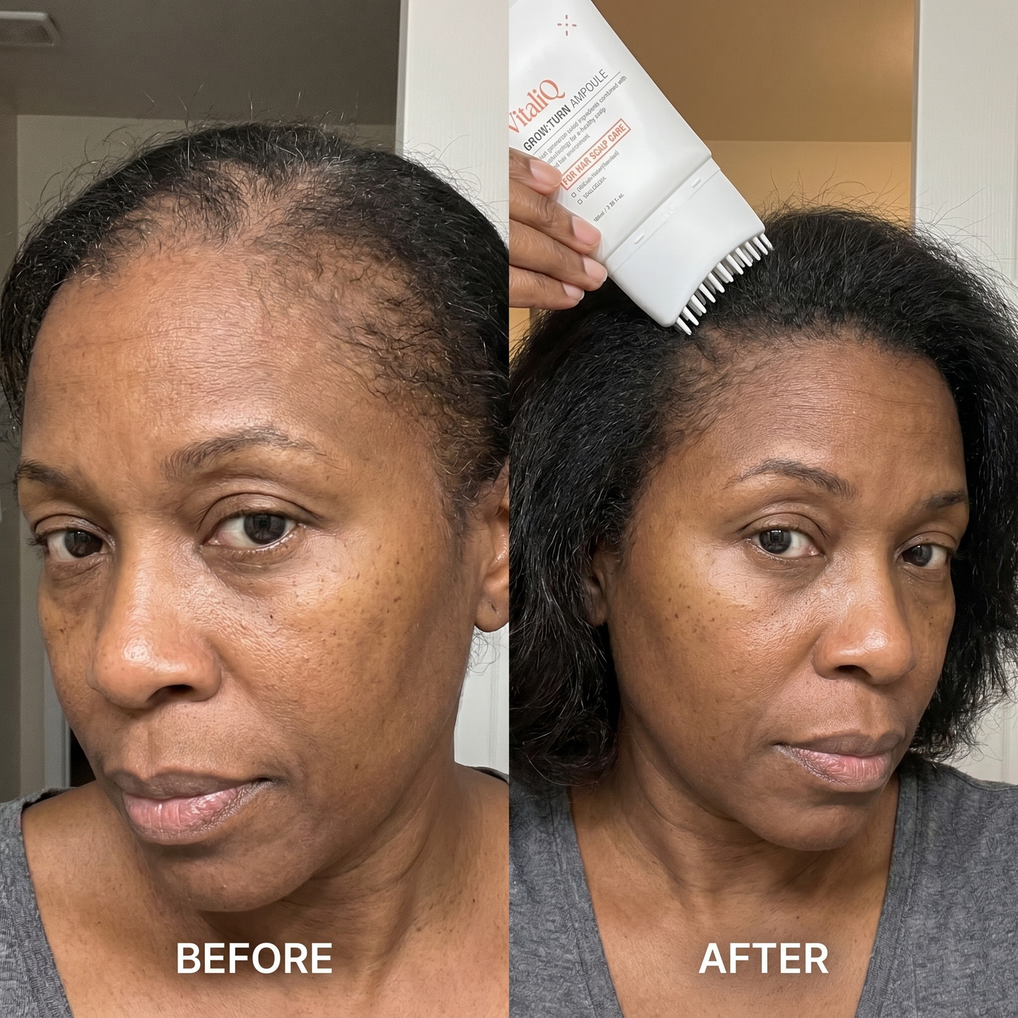 VitaliQ Advanced Hair Growth Serum