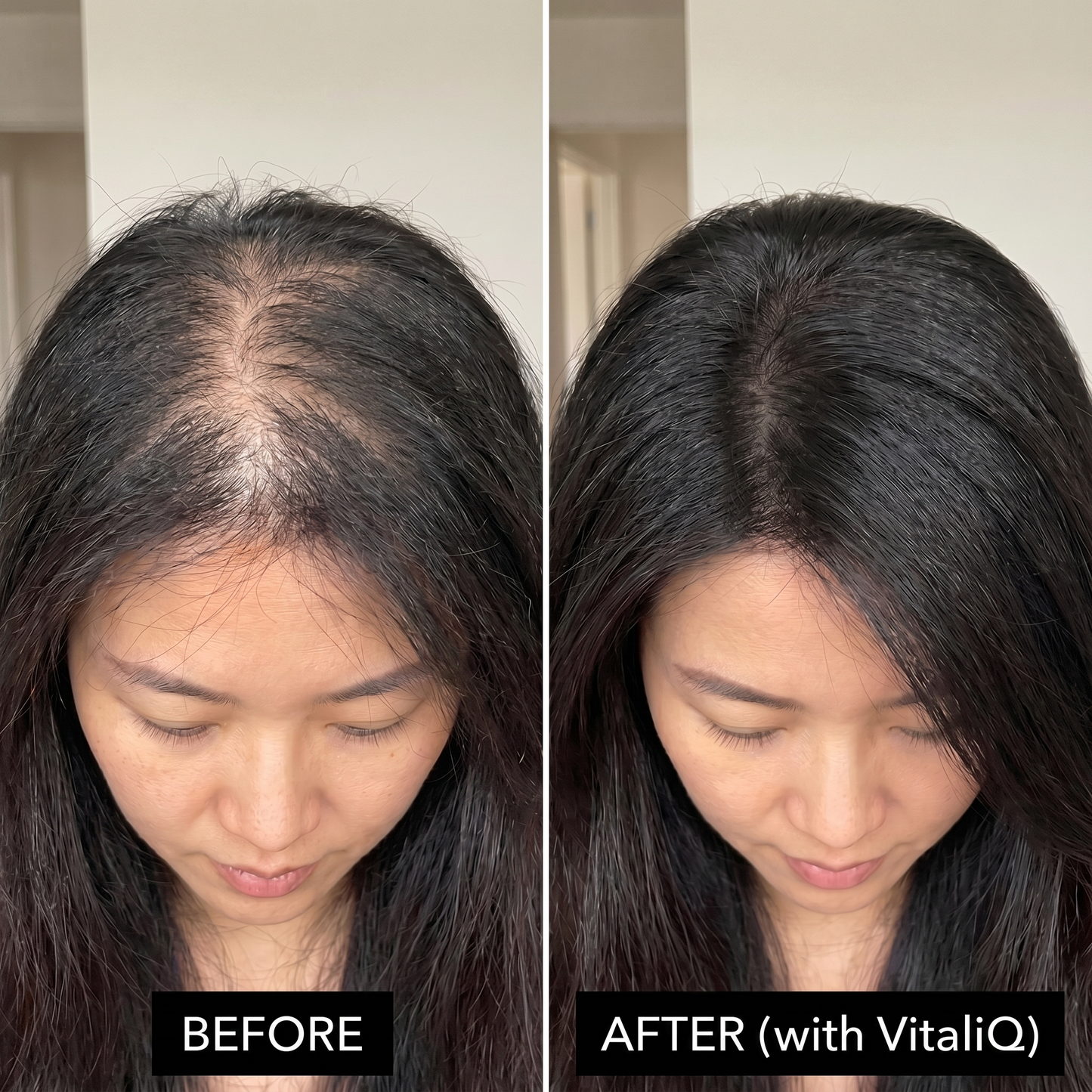 VitaliQ Advanced Hair Growth Serum