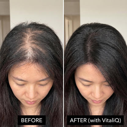 VitaliQ Advanced Hair Growth Serum