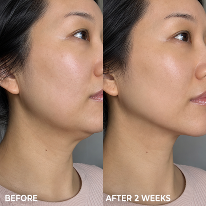 PDRN Collagen Gua Sha