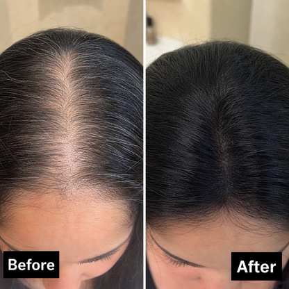 Vitaliq Shape Tape™ Dab & Go Hair Concealer