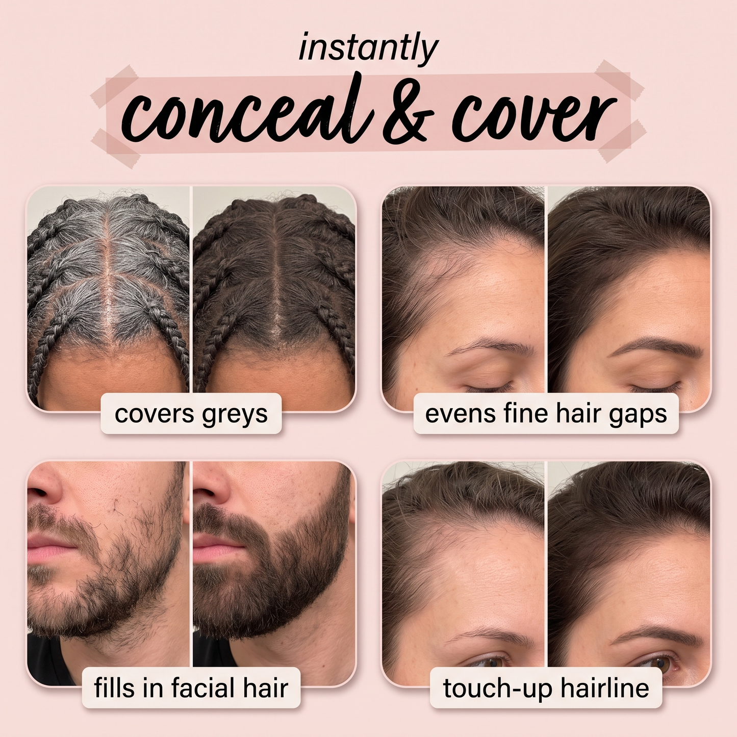 Vitaliq Shape Tape™ Dab & Go Hair Concealer