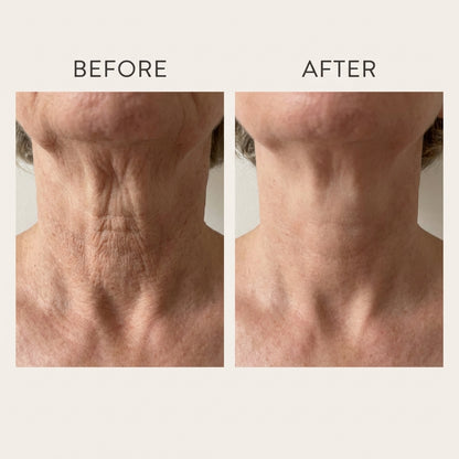 Neck Tightening Cream
