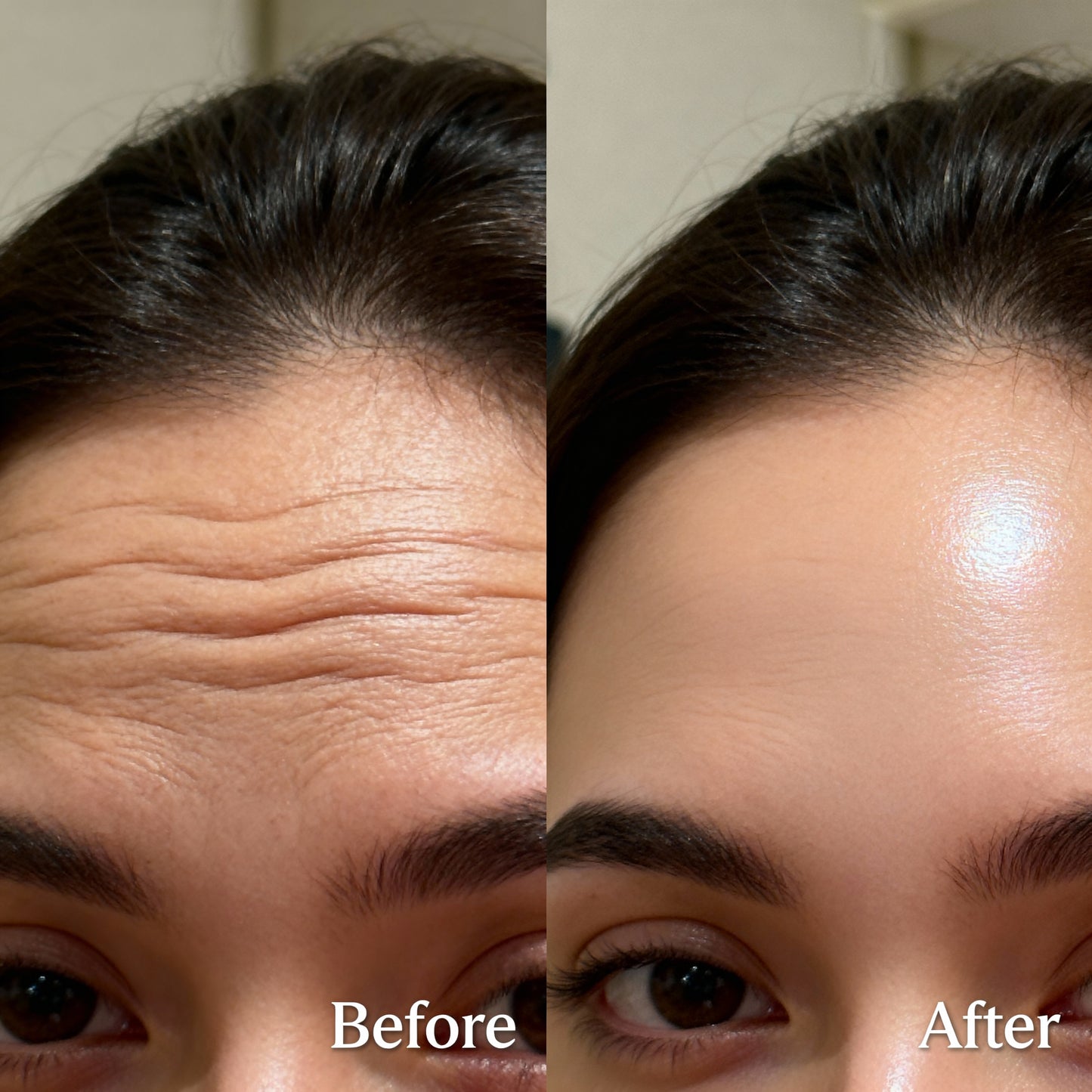 Korean Lumi Anti-Aging Liquid Microneedling Duo